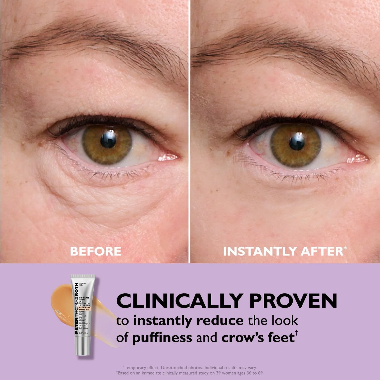 ✨ Instant Eye Tightener Primer – Firming Under Eye Serum with Hyaluronic Acid & Vitamin E